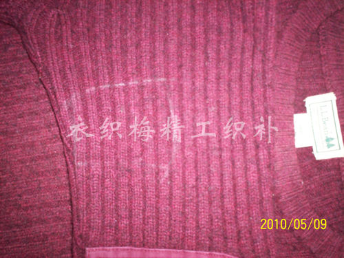 织补后
