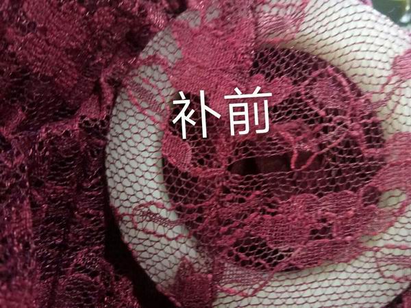 织补前