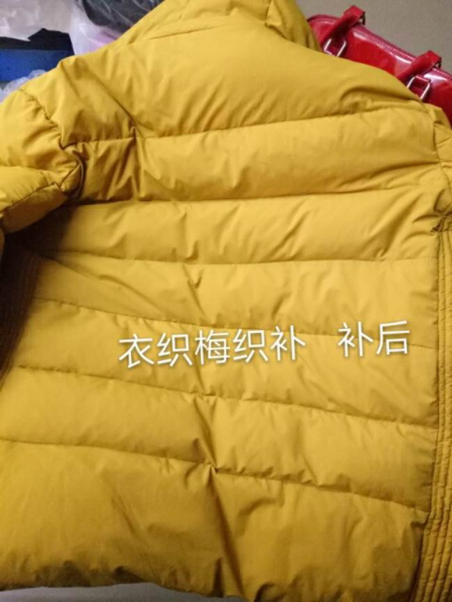 织补后